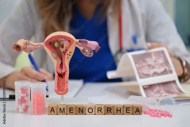 Amenorrhea Symptoms, Causes, and Treatment Options